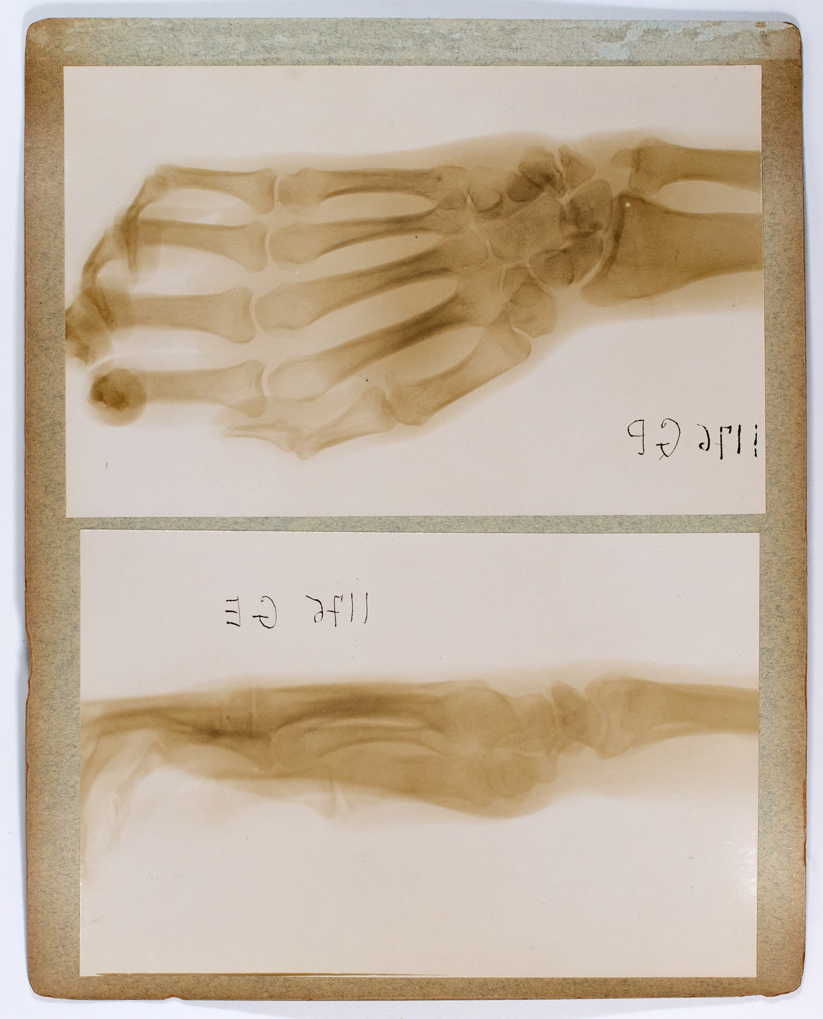 Lot image - [PHOTOGRAPHY--MEDICAL]  Eight X-ray photographs mounted on seven card mounts,